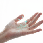 ia japonesa detecta doenca rara com foto simples da mao